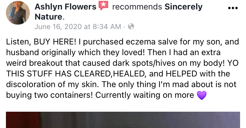 Eczema Salve
